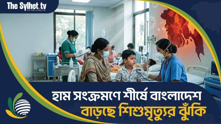 হাম সংক্রমণে শীর্ষে বাংলাদেশ, বাড়ছে শিশুমৃত্যুর ঝুঁকি