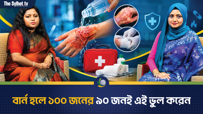 বার্ন হলে ১০০ জনের ৯০ জনই এই ভুল করেন